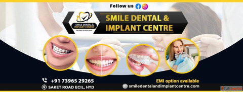 Invisalign near me Invisalign Provider in Secunderabad
