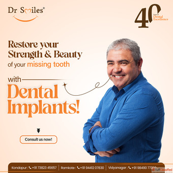 Best Dental Implants Kondapur - Dr Smiles