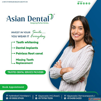 Best Dentist in Kondapur - Asian Dental