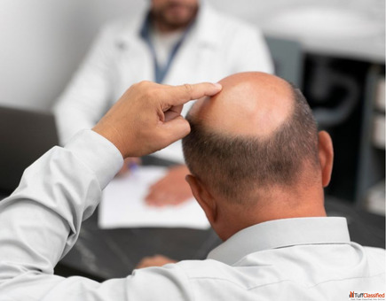 Best Hair Transplant Clinics in Varanasi with Affordable Cost