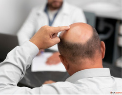 Best Hair Transplant Clinics in Varanasi with Affordable Cos...