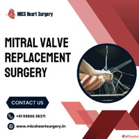 Mitral Valve Replacement Surgery Bangalore MICS Cost
