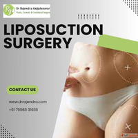 Liposuction Surgery in Bangalore Safe Effective Fat Removal