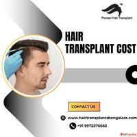 Hair Transplant Clinics in Bangalore Hair Transplant Cost