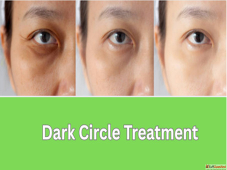 Brighten Eyes with Dark Circle Treatment in Mumbai Gloss Clinic