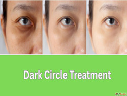 Brighten Eyes with Dark Circle Treatment in Mumbai Gloss Cli...