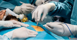 Laparoscopic Surgery Hospital in Chennai