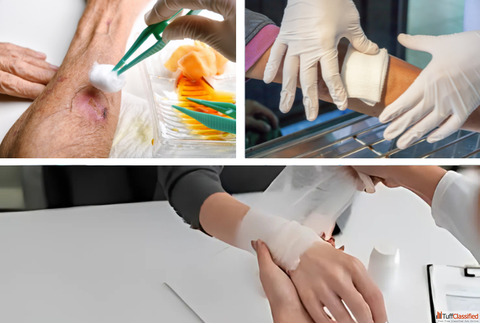Wound Dressing Services in Kolkata Home Care Services