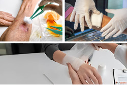 Wound Dressing Services in Kolkata Home Care Services