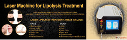 Looking for a Reliable Laser Machine for Lipolysis Treatment