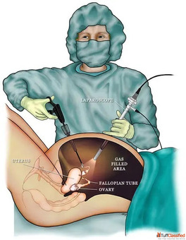 Best Laparoscopy Training in India