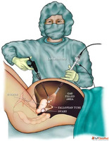 Best Laparoscopy Training in India