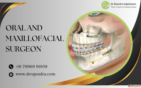 Best Oral Maxillofacial Surgeon Bangalore Expert Trauma Care
