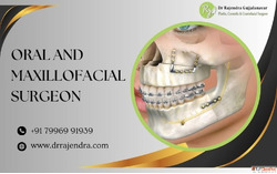 Best Oral Maxillofacial Surgeon Bangalore Expert Trauma Care