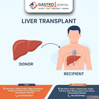 Book Your Liver Transplant Consultation at Gastro1 Hospital ...