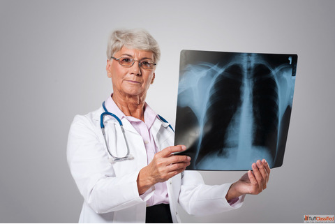 Best Lung Cancer Specialist in India with Homeopathy Medicine