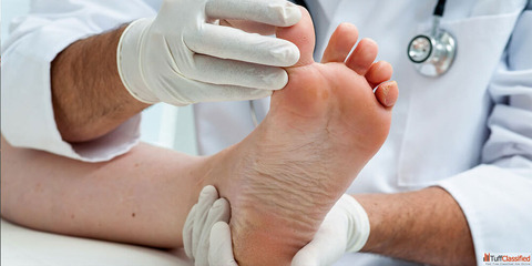 Diabetes Foot Care in East Delhi
