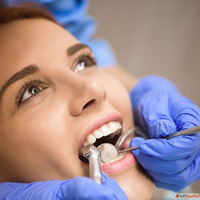 Tooth Removal in Dubai