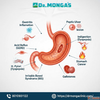Gastroenterologist ayurvedic doctor