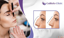 Best Rhinoplasty Experts in Surat - Callisto Clinic