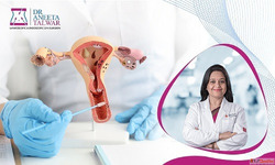 Expert TLH Surgery in Whitefield by Dr. Aneeta Talwar