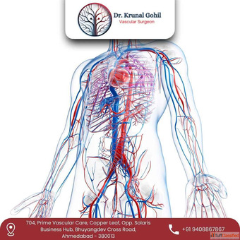 Best Vascular Surgeon in Ahmedabad India for Injury Care