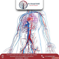Best Vascular Surgeon in Ahmedabad India for Injury Care