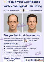 "Bengaluru's Trusted Nonsurgical Hair Restoration&...