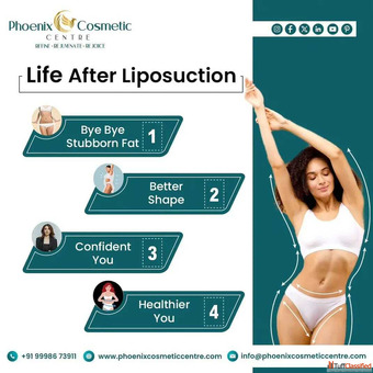 Best Liposuction Surgery in Ahmedabad at Phoenix Cosmetic