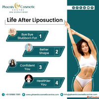 Best Liposuction Surgery in Ahmedabad at Phoenix Cosmetic