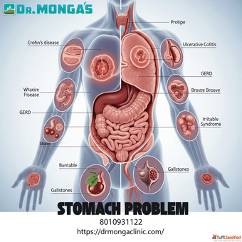 Ayurvedic doctor for stomach in Delhi