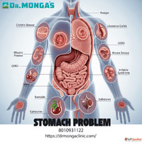 Ayurvedic doctor for stomach in Delhi