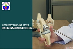 Recovery Timeline After Knee Replacement Surgery Step-by-Ste...