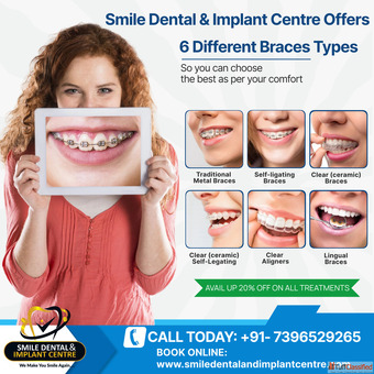 Best Dental Clinic for Braces Treatment in AS Rao Nagar Hyderabad