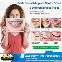Best Dental Clinic for Braces Treatment in AS Rao Nagar Hyde...