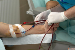 Dr. Dharav Kheradia - Leading AV Fistula Specialist in Mumba...