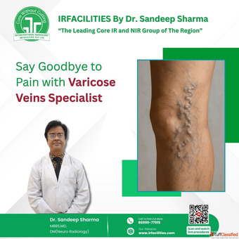 Expert Varicose Veins Specialist for Advanced Care Lasting Relief