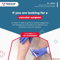 Comprehensive Vein Treatment by Expert in Mumbai