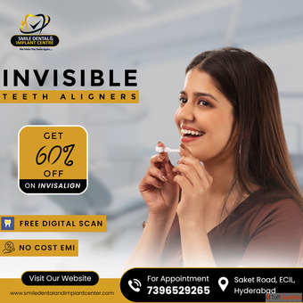 Best Invisalign Braces Treatment in Hyderabad Invisalign Near me
