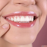 Gum Contouring in Dubai