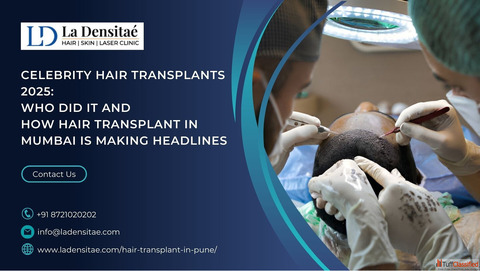 Celebrity Hair Transplants 2025 Who Did It and How Hair Transplant in Mumbai Is Making Headlines