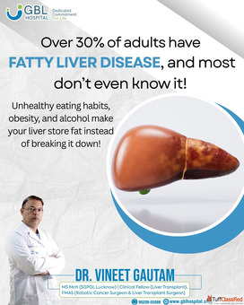 Fatty Liver Treatment in Indore GBL Hospital