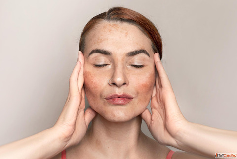 Best Homeopathic Medicine for Pigmentation in India