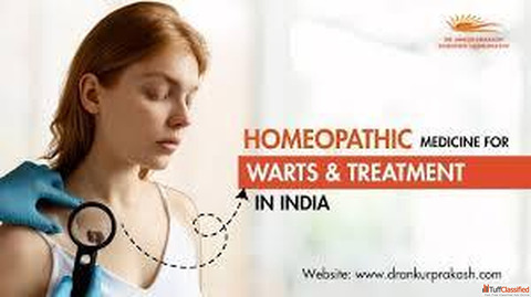 Best Homeopathic Doctors for Warts in Agra Dr. Ankur Prakash