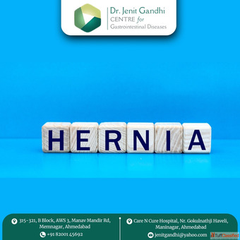 Dr. Jenit Gandhi - Leading Gastro Surgeon for Colon Cancer in Ahmedabad India