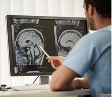 Best Neurologist Doctor in Noida