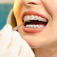 Orthodontists in Dubai