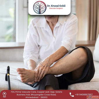 Advanced PAD Treatment in Ahmedabad India - Dr. Krunal Gohil