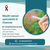 Mouth Cancer Specialists In Chennai - Mouthcancer Surgeons