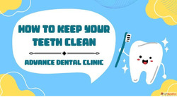 How to Keep Your Teeth Clean
